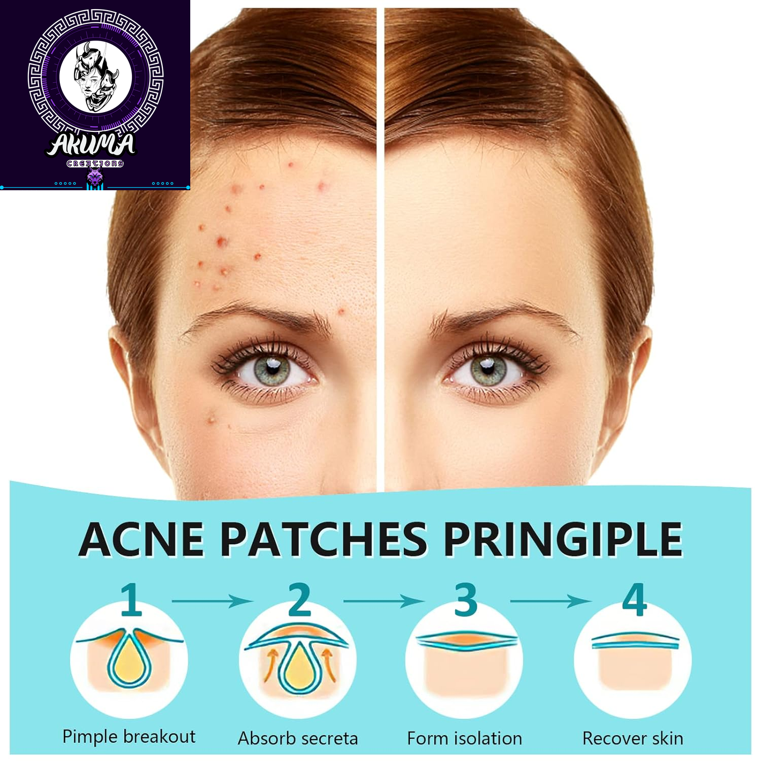 180 Counts Pimple Patches for Face Hydrocolloid Acne Patches for Face Invisible Zit Patches for Face Pimple Patch Acne Spot Treatment Patch Blemish Patches Cover Patches Stickers